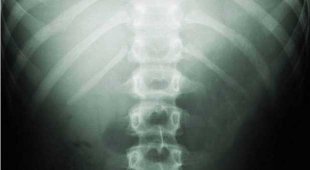 spine