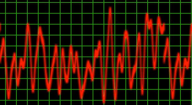 pulse monitor