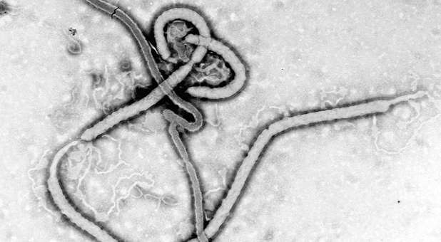 Ebola virus