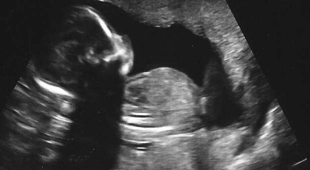 Is the Church to Blame for 56 Million Babies Aborted?