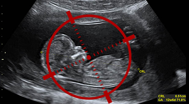 Sonogram