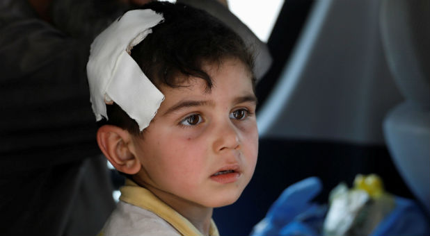 A displaced wounded Iraqi child rescued at the site of battle is transported by the Iraqi forces at the Old City in Mosul, Iraq.