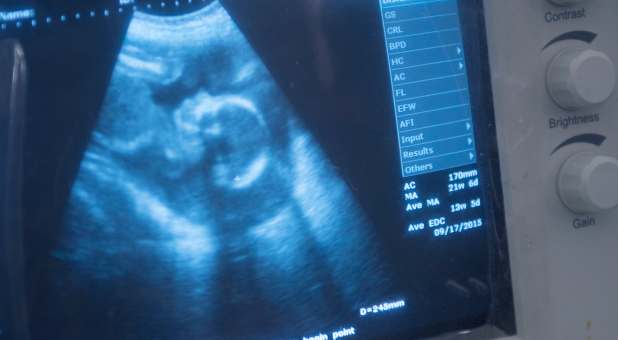 How Science, Sonograms, Scripture Confirm Unborn Babies Are Not Mere ‘Blobs’